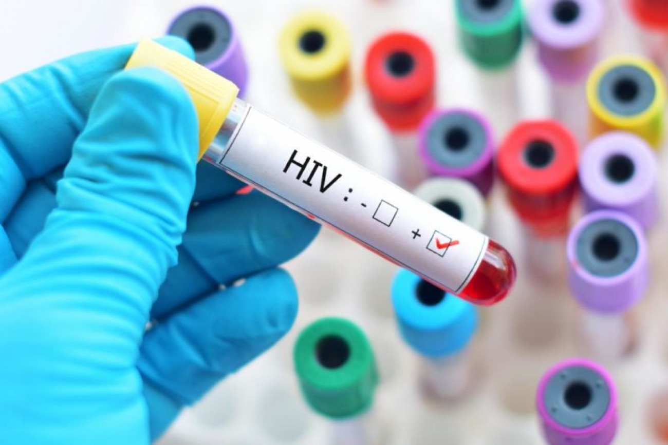 Pílula para prevenção de HIV não precisa ser usada diariamente, afirma OMS