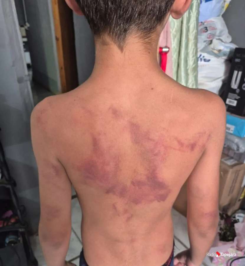 Criança de 10 anos é vítima de agressão em residência no bairro Vera Cruz, em Passo Fundo